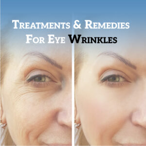 How To Rid of Wrinkles Around Eyes: Proven Treatments & Remedies