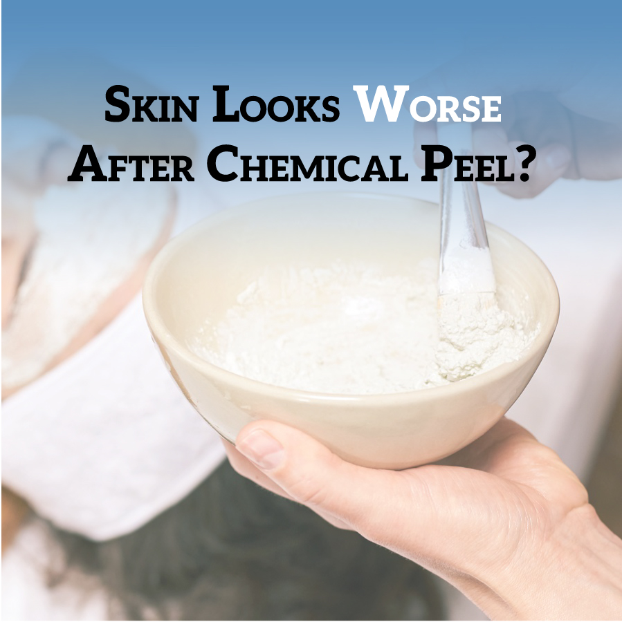 Skin Looks Worse After Chemical Peel?- Before and after results of a chemical peel treatment showing improved skin texture and tone.